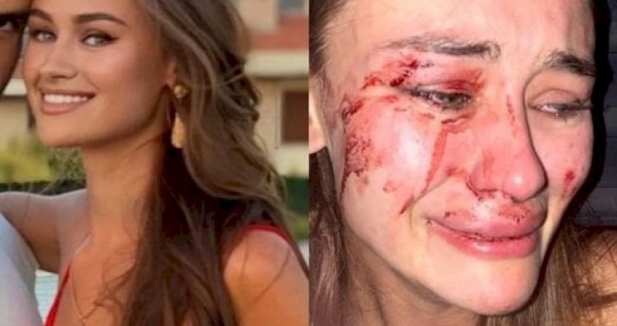 İzmirdə döyülən ukraynalı modellə bağlı təhqiqat başladı