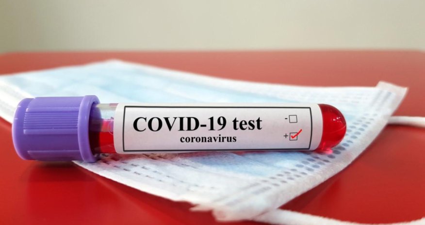 Число случаев COVID-19 в Армении превысило 39 тыс.