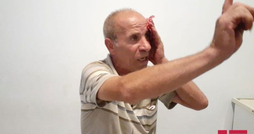 Xalq artistinin qardaşı döyüldü — FOTOLAR