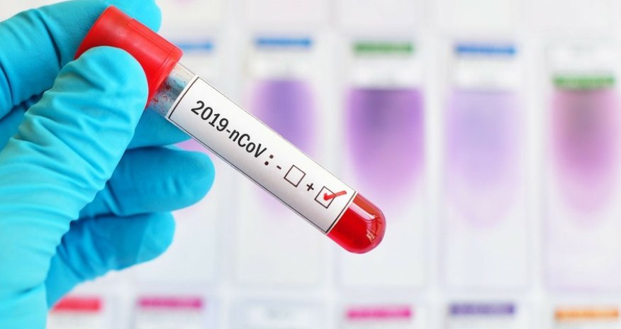 В Азербайджане 103 новых случая заражения коронавирусом