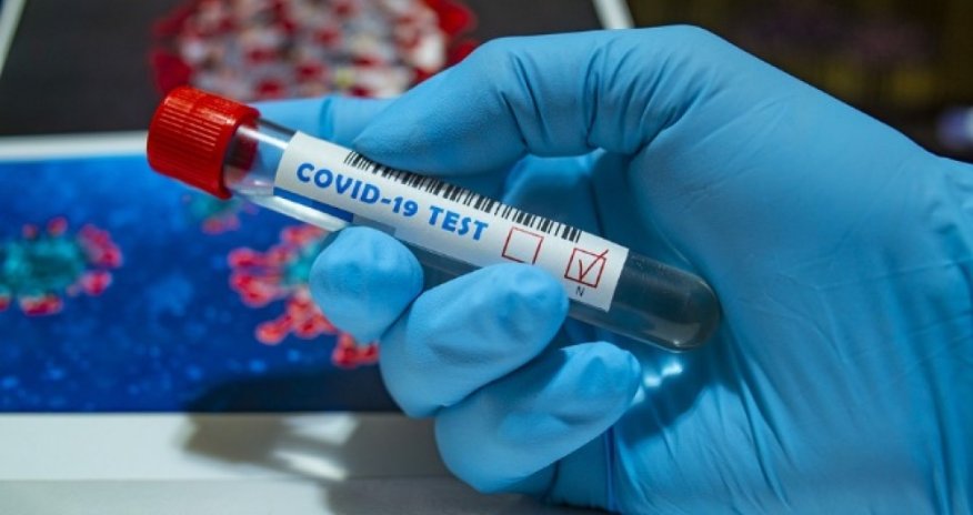 Daha bir həkim COVİD-19-dan vəfat edib - FOTO