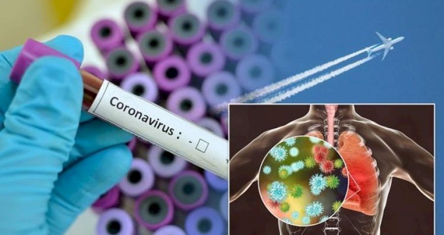 Rusiyada 5 509 yeni yoluxma - 57 nəfər öldü