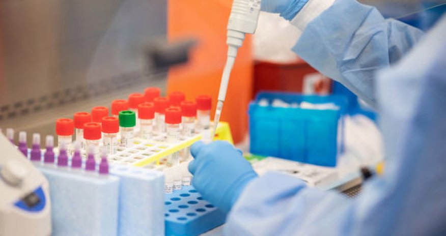 Bu gün Azərbaycanda 146 nəfər COVID-19-a yoluxub, bir nəfər vəfat edib