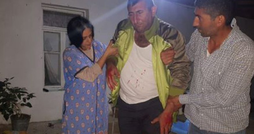 Ermənilərin yaraladığı mülki vətəndaşımızın - Fotosu