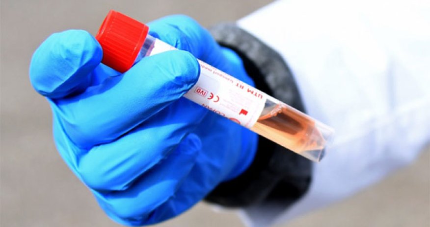 Azərbaycanda koronavirusa yoluxanların sayı yenidən artdı - STATİSTİKA