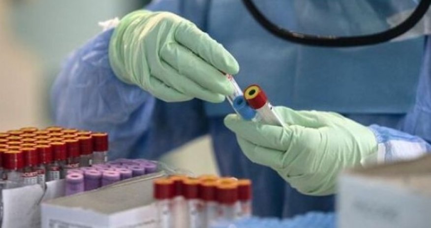 Rusiyada koronavirusa sutkalıq yoluxma sayı 17 mini ötdü