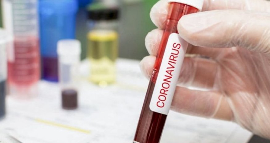 Ermənistanda koronavirusdan daha 38 nəfər öldü