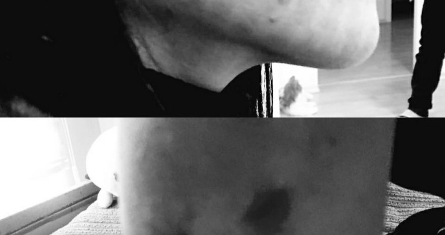 Bakıda qadın və uşaq sığınacağına hücum olub, xəsarət alanlar var