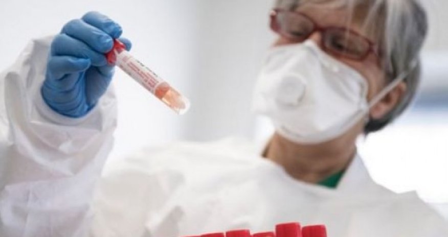 Azərbaycanda koronavirusa yoluxanların və ölənlərin sayı artdı