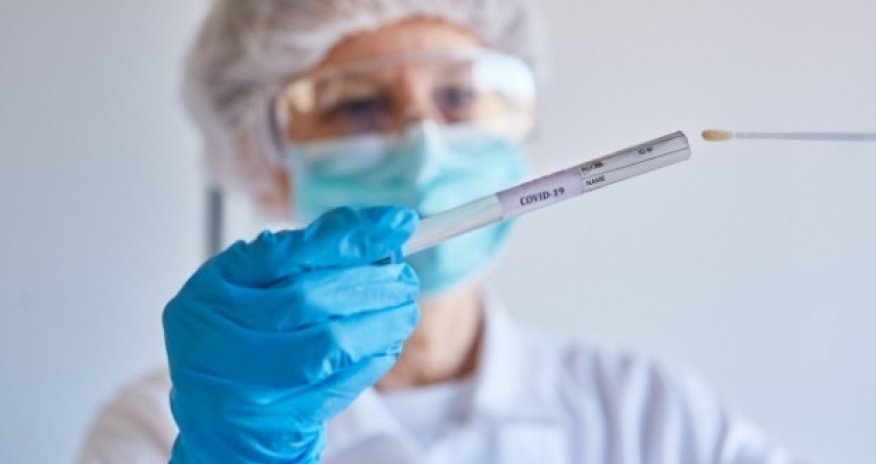 Son sutkada 7 mindən çox test aparılıb