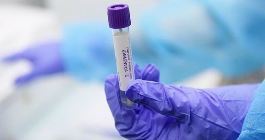 Azərbaycanda son sutkada koronavirusa yoluxanların sayı AÇIQLANDI