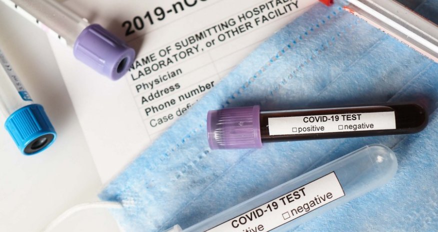 Azərbaycanda koronavirusdan sağalanların sayı yoluxmanı üstələyib