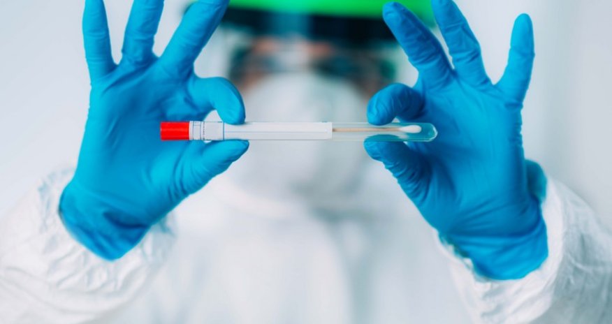 В Азербайджане выявлено 995 новых случаев заражения коронавирусом