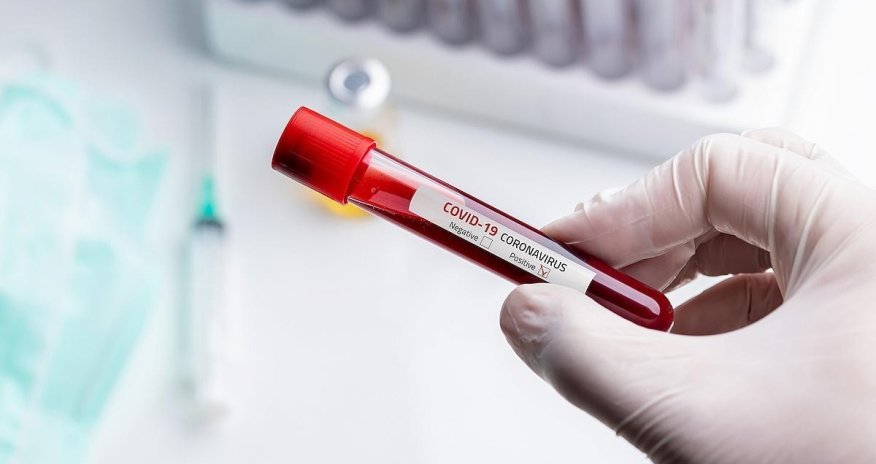 Azərbaycanda koronavirusa yoluxanların sayı AÇIQLANDI