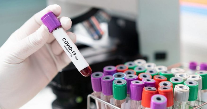 В Азербайджане коронавирусом заразились еще 284 человек