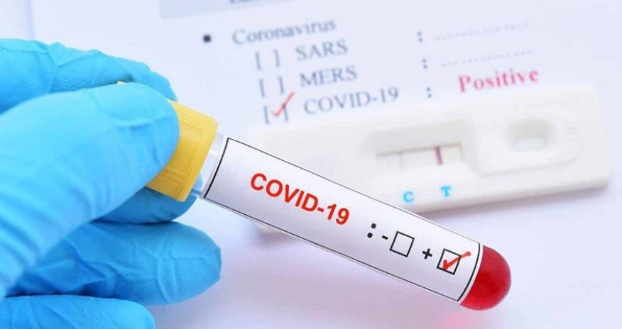 За последние сутки объявлено количество зараженных коронавирусом