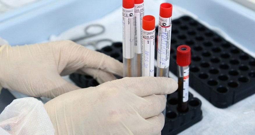 Azərbaycanda koronavirusa yoluxanların sayı AÇIQLANDI