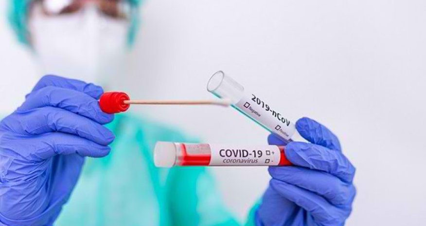 Yoluxanların sayı artdı