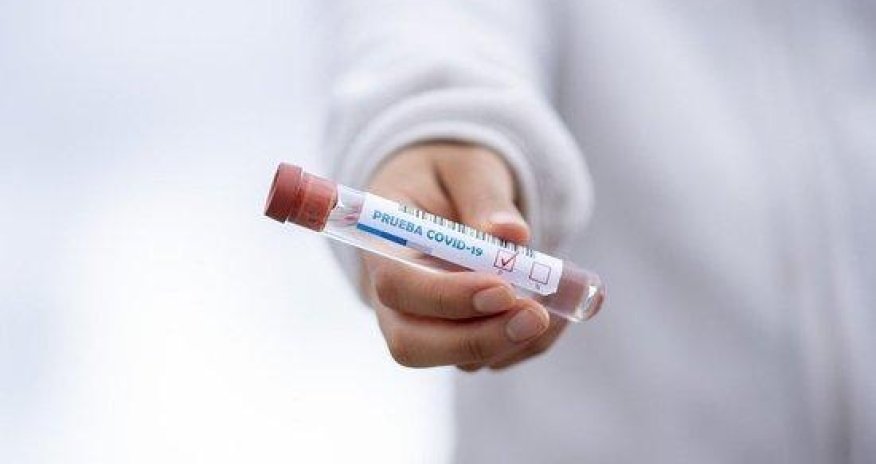 Günün koronavirusa yoluxma statistikası