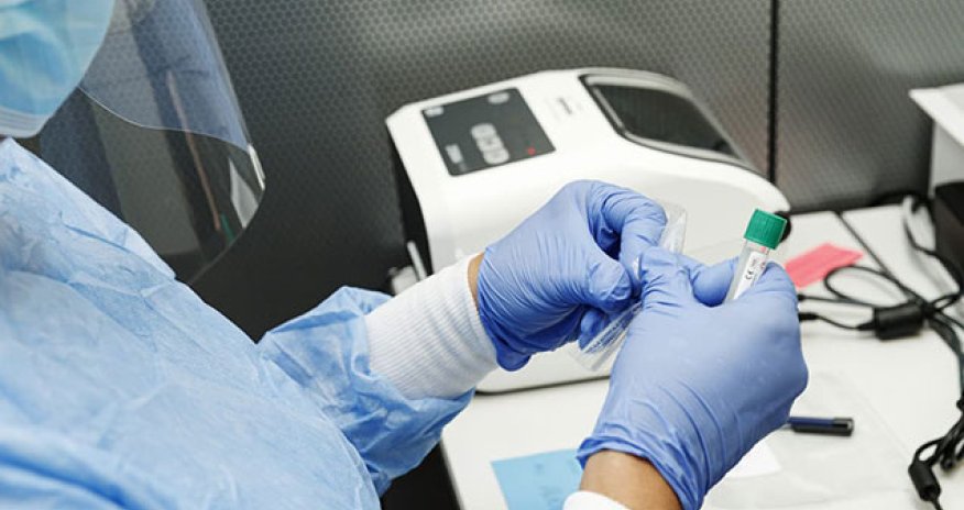 Yoluxanların bu günə olan statistikası