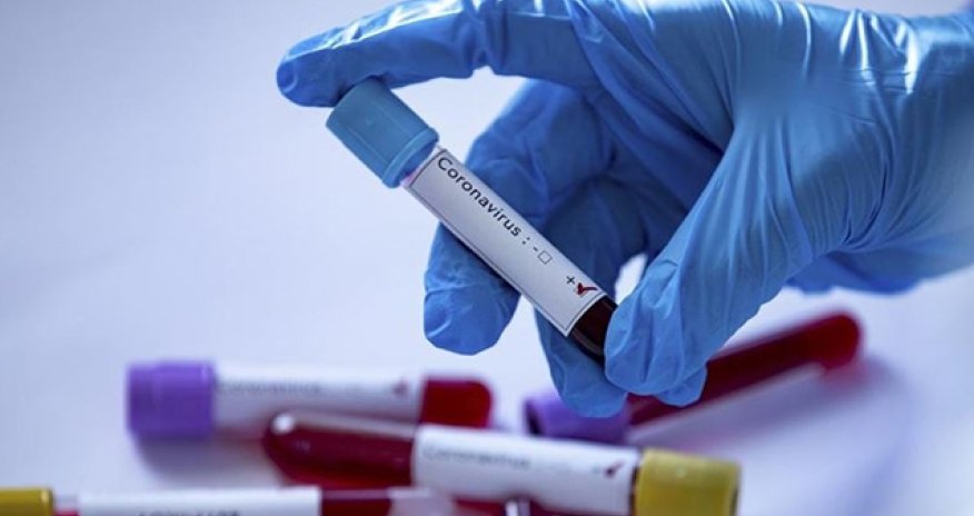 “Tokio-2020”də daha 18 nəfərdə koronavirus aşkarlandı