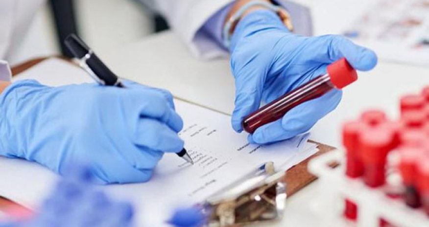 Yoluxanların da sayı artdı, ölənlərin də