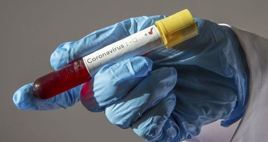 Yoluxanların sayı açıqlandı