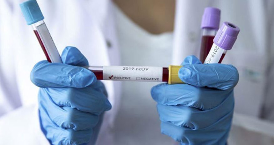 Yoluxanların sayı açıqlandı