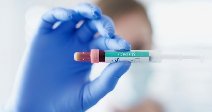 В Грузии за сутки от COVID-19 умерли 47 человек