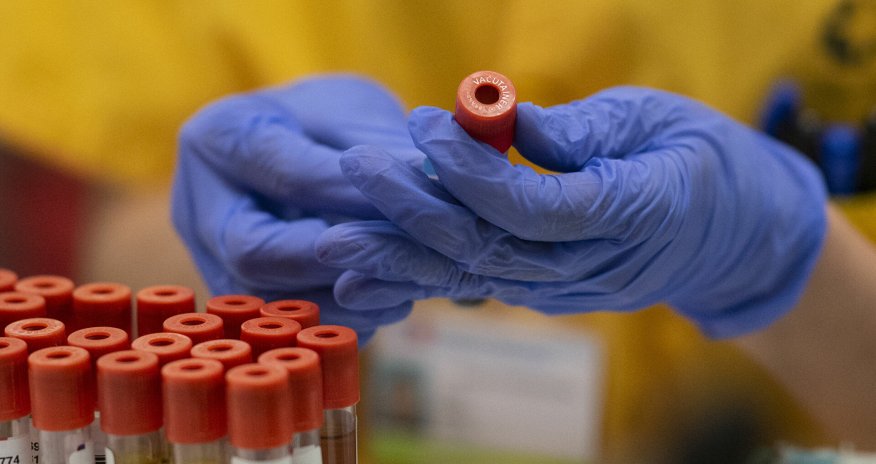 В Азербайджане за последние сутки коронавирусом заразились 1 017 человек