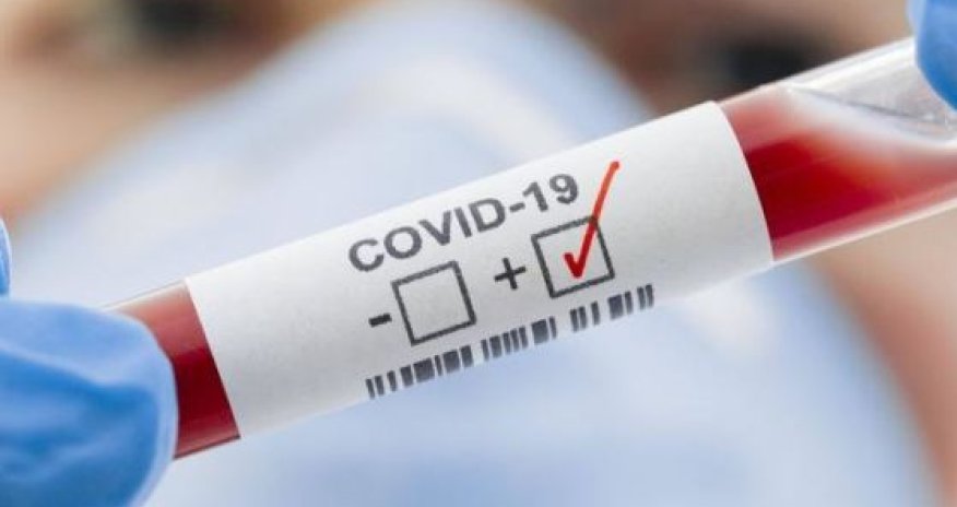 Today's statistics of COVID-19 in Azerbaijan