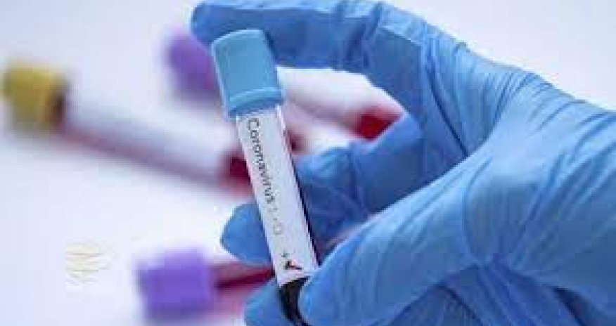 Azərbaycanda bu günə olan koronavirus statistikası