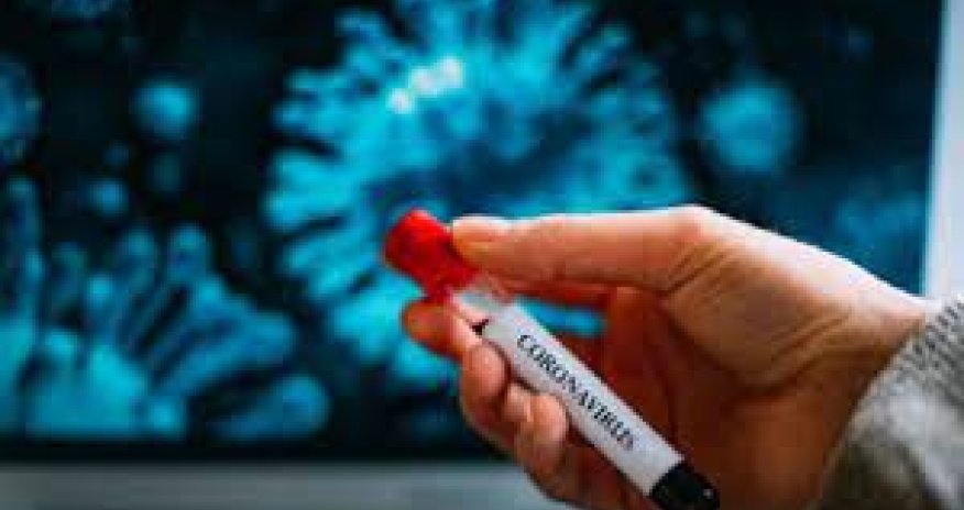 Azərbaycanda bu günə olan koronavirus statistikası