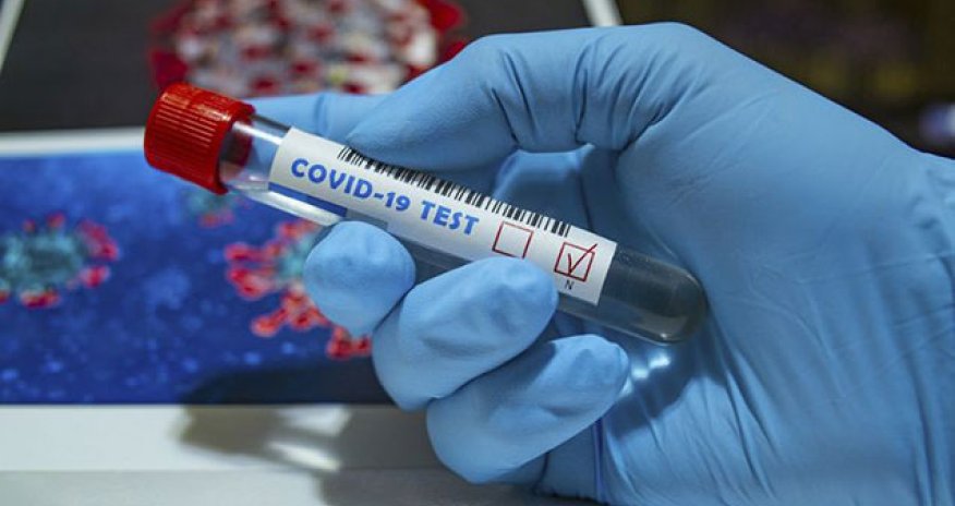 Yoluxanların bu günə olan statistikası