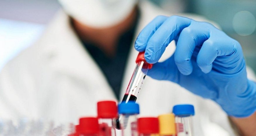 Omicron strain not detected in Azerbaijan