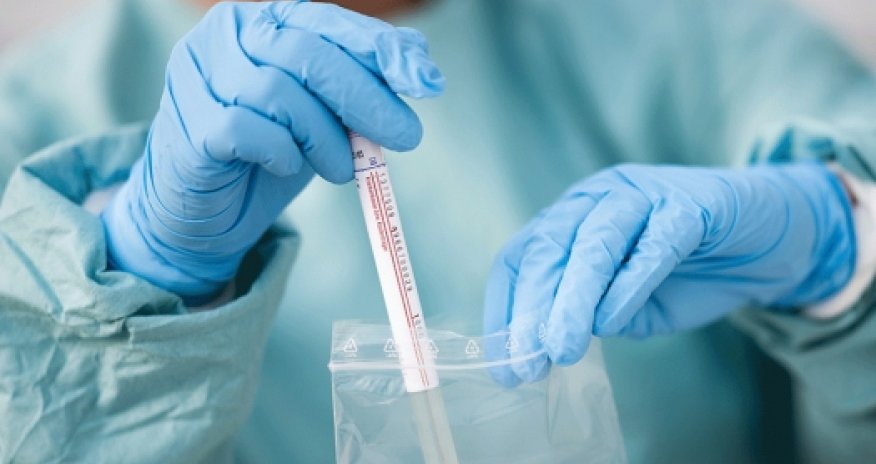 Российский ученый: Можно заразиться сразу двумя штаммами коронавируса