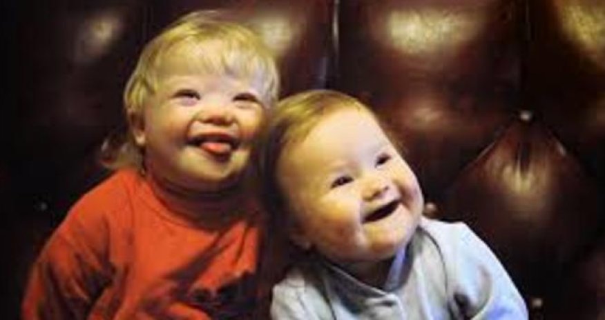 Daun sindromlu uşağın bir günü-VİDEO