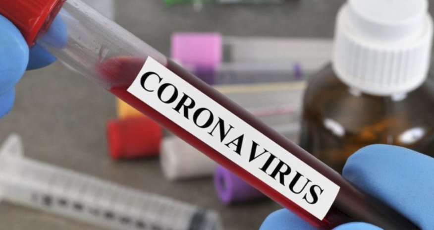 Son sutkada Rusiyada koronavirusa yoluxanların STATİSTİKASI 
