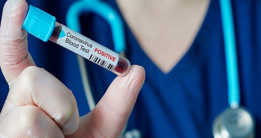 Bir sutkada nə qədər adam yoluxub?