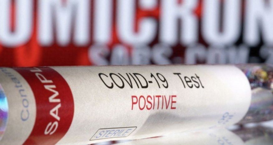 Минздрав о состоянии здоровья инфицированных «омикроном» в Азербайджане