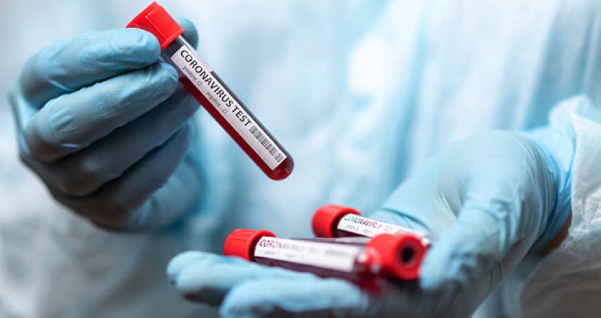 Bu gün neçə nəfər yoluxub?