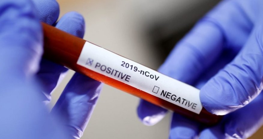 В Азербайджане коронавирусом заразились еще 1 614 человек