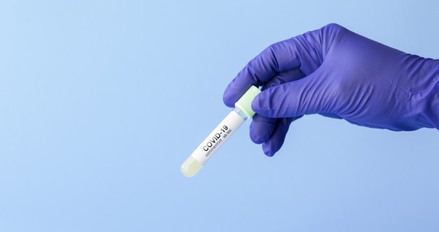 В Азербайджане за сутки выявлено 3 192 случая заражения коронавирусом