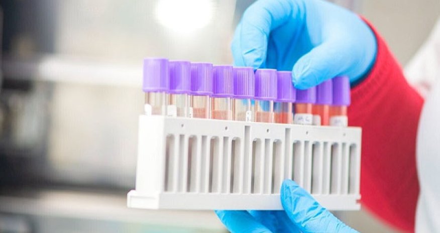 Rusiyada nazal peyvəndin kliniki sınaqları başladı