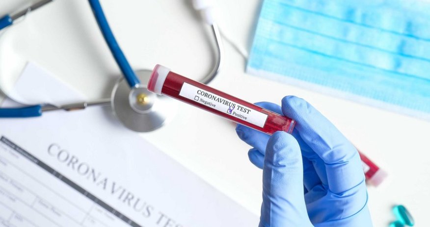 Azerbaijan confirms 36 new COVID-19 cases, 2 died