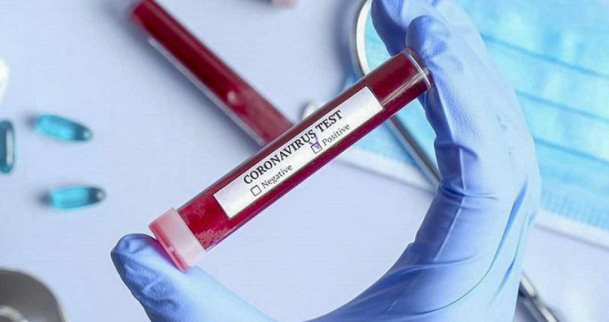 Rusiyada daha 14 355 nəfər koronavirusa yoluxub