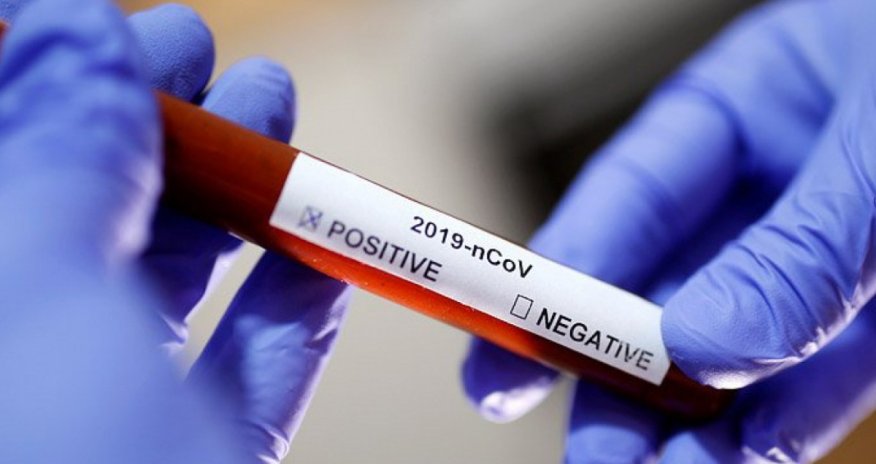 Rusiyada yoluxma artıb