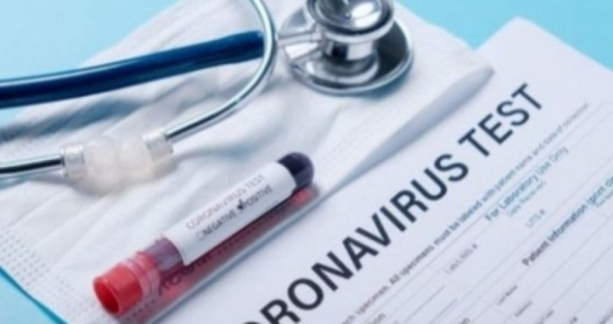 В Азербайджане за сутки выявлено 11 случаев заражения коронавирусом