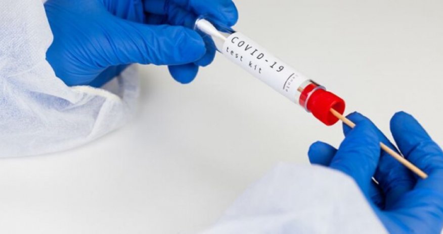 Bu ölkədə PCR testi ləğv edilir