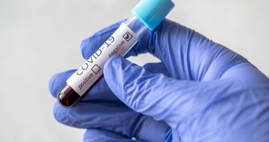 Dünyada koronavirusla bağlı son STATİSTİKA